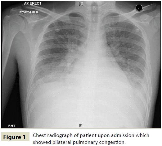 insightsinchestdiseases-Chest-radiograph-patient