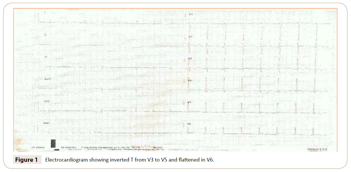 insightsinchestdiseases-Electro-cardiogram