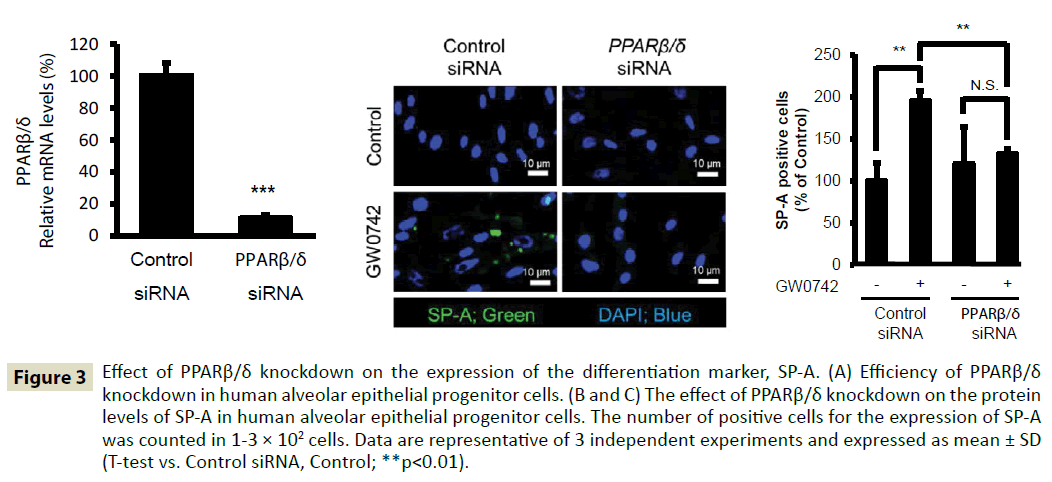 insightsinchestdiseases-expression-differentiation-marker